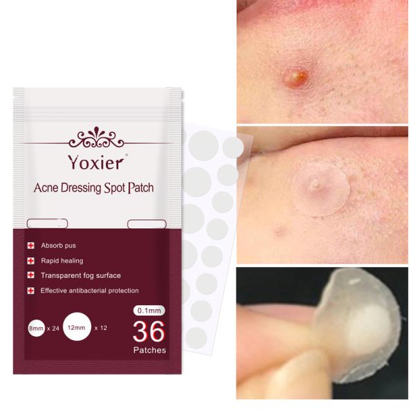 Skin Care Tools Acne Dressing Spot Patch Blemish Treatment Invisible Acne Stickers Pimple Remover Set Face Cream - Image 2